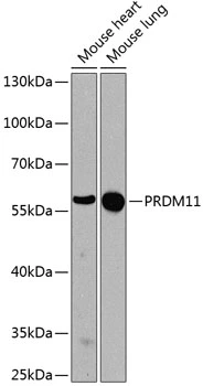 WB analysis of various sample lysates using GTX64967 PRDM11 antibody. The signal was developed with ECL plus-Enhanced. Dilution : 1:1000 Loading : 25microg per lane WB analysis of various sample lysates using GTX64967 PRDM11 antibody. The signal was developed with ECL plus-Enhanced. Dilution : 1:1000 Loading : 25microg per lane