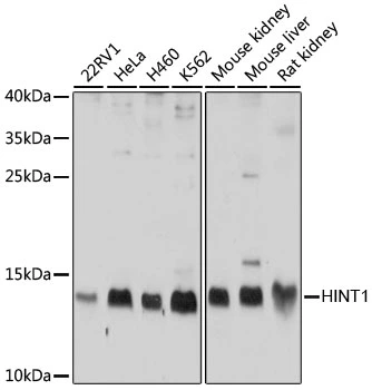 WB analysis of various sample lysates using GTX64971 HINT1 antibody. Dilution : 1:1000 Loading : 25microg per lane