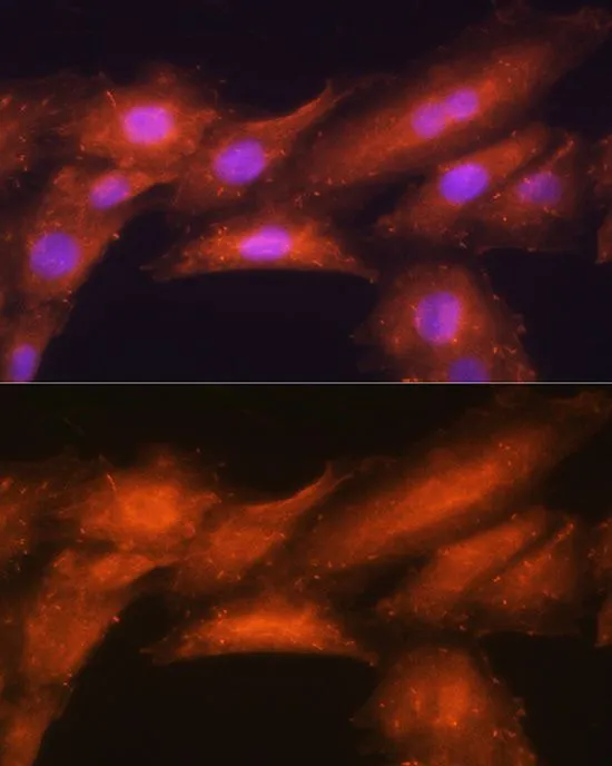 ICC/IF analysis of H9C2 cells using GTX64971 HINT1 antibody. Blue : DAPI Dilution : 1:100