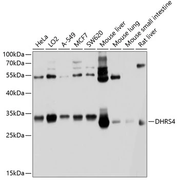 WB analysis of various sample lysates using GTX64973 DHRS4 antibody. Dilution : 1:1000 Loading : 25microg per lane WB analysis of various sample lysates using GTX64973 DHRS4 antibody. Dilution : 1:1000 Loading : 25microg per lane