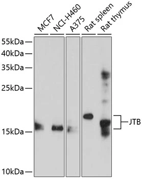 WB analysis of various sample lysates using GTX64974 JTB antibody. The signal was developed with ECL plus-Enhanced. Dilution : 1:1000 Loading : 25microg per lane WB analysis of various sample lysates using GTX64974 JTB antibody. The signal was developed with ECL plus-Enhanced. Dilution : 1:1000 Loading : 25microg per lane