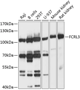 WB analysis of various sample lysates using GTX64975 FcRL3 antibody. Dilution : 1:1000 Loading : 25microg per lane WB analysis of various sample lysates using GTX64975 FcRL3 antibody. Dilution : 1:1000 Loading : 25microg per lane
