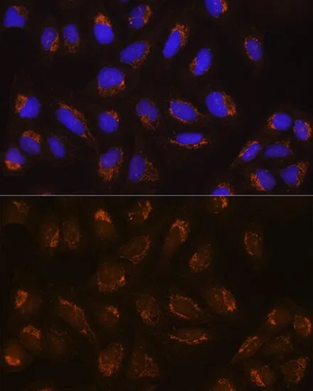 ICC/IF analysis of U2OS cells using GTX64979 POFUT2 antibody. Blue : DAPI Dilution : 1:100