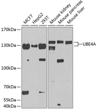 WB analysis of various sample lysates using GTX64985 UBE4A antibody. Dilution : 1:1000 Loading : 25microg per lane WB analysis of various sample lysates using GTX64985 UBE4A antibody. Dilution : 1:1000 Loading : 25microg per lane