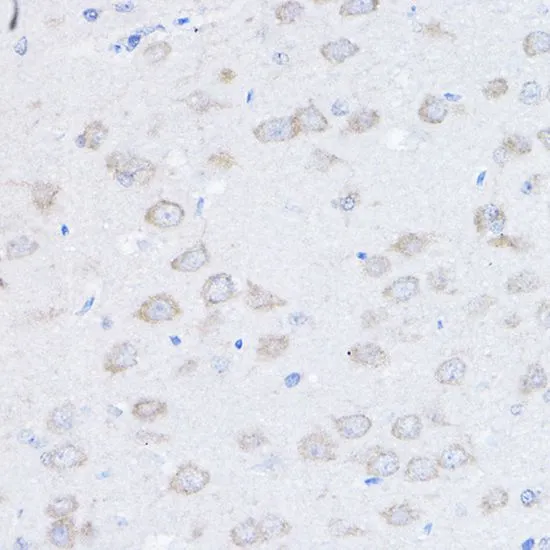 IHC-P analysis of rat brain tissue using GTX64985 UBE4A antibody. Dilution : 1:100
