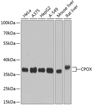 WB analysis of various sample lysates using GTX64986 CPOX antibody. Dilution : 1:1000 Loading : 25microg per lane WB analysis of various sample lysates using GTX64986 CPOX antibody. Dilution : 1:1000 Loading : 25microg per lane