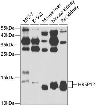 WB analysis of various sample lysates using GTX64987 HRSP12 antibody. Dilution : 1:1000 Loading : 25microg per lane WB analysis of various sample lysates using GTX64987 HRSP12 antibody. Dilution : 1:1000 Loading : 25microg per lane