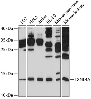 WB analysis of various sample lysates using GTX64992 TXNL4A antibody. Dilution : 1:1000 Loading : 25microg per lane WB analysis of various sample lysates using GTX64992 TXNL4A antibody. Dilution : 1:1000 Loading : 25microg per lane