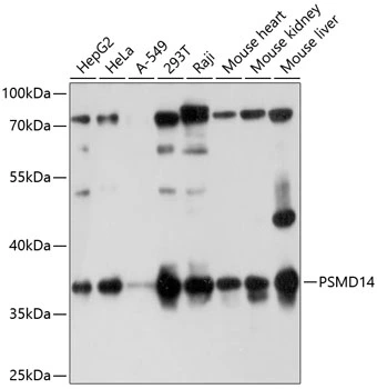 WB analysis of various sample lysates using GTX64996 PSMD14 antibody. Dilution : 1:1000 Loading : 25microg per lane WB analysis of various sample lysates using GTX64996 PSMD14 antibody. Dilution : 1:1000 Loading : 25microg per lane