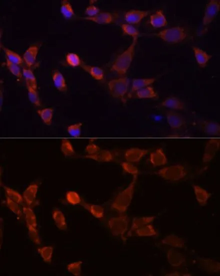 ICC/IF analysis of NIH/3T3 cells using GTX64996 PSMD14 antibody. Blue : DAPI Dilution : 1:100