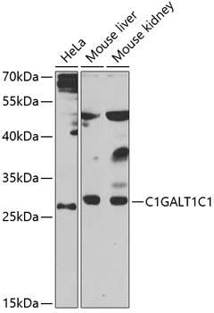 WB analysis of various sample lysates using GTX65533 C1GALT1C1 antibody. Dilution : 1:1000 Loading : 25microg per lane WB analysis of various sample lysates using GTX65533 C1GALT1C1 antibody. Dilution : 1:1000 Loading : 25microg per lane