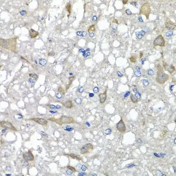 IHC-P analysis of rat brain tissue using GTX65533 C1GALT1C1 antibody. Dilution : 1:100