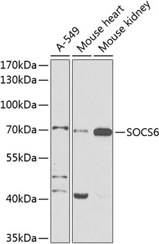 WB analysis of various sample lysates using GTX65551 SOCS6 antibody. Dilution : 1:1000 Loading : 25microg per lane WB analysis of various sample lysates using GTX65551 SOCS6 antibody. Dilution : 1:1000 Loading : 25microg per lane