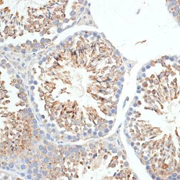 IHC-P analysis of mouse testis tissue using GTX65557 KLHL9 antibody. Dilution : 1:100