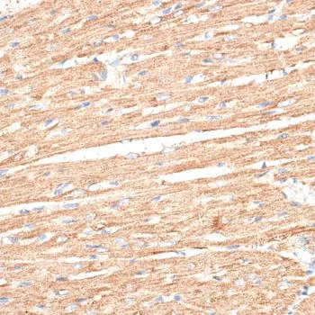 IHC-P analysis of rat heart tissue using GTX65557 KLHL9 antibody. Dilution : 1:100