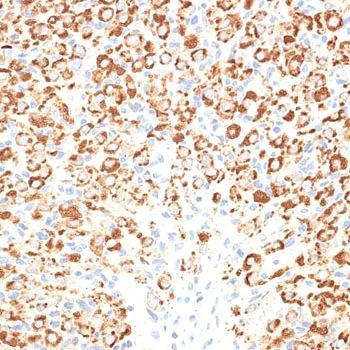 IHC-P analysis of rat ovary tissue using GTX65557 KLHL9 antibody. Dilution : 1:100