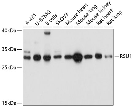 WB analysis of various samples using GTX65563 RSU1 antibody. Dilution : 1:1000 Loading : 25ug per lane