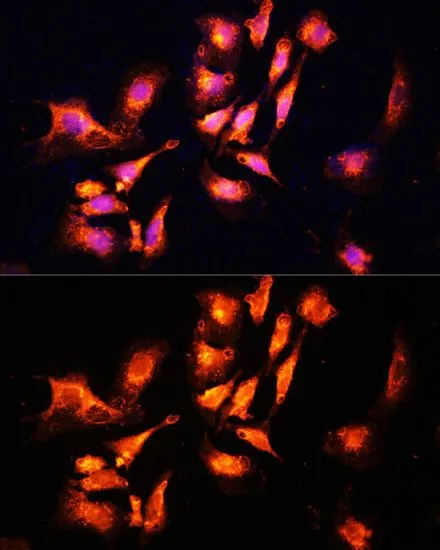 ICC/IF analysis of U2OS cells using GTX65564 LAMTOR1 antibody. Blue : DAPI Dilution : 1:100