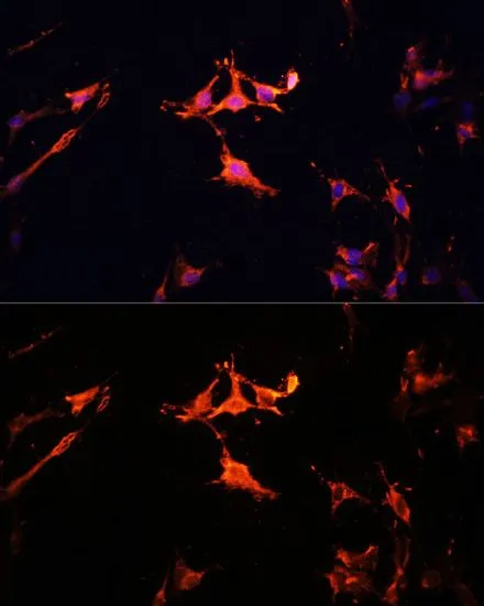 ICC/IF analysis of C6 cells using GTX65564 LAMTOR1 antibody. Blue : DAPI Dilution : 1:100