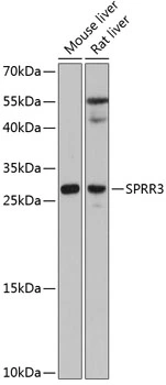 WB analysis of various sample lysates using GTX65568 SPRR3 antibody. Dilution : 1:3000 Loading : 25microg per lane WB analysis of various sample lysates using GTX65568 SPRR3 antibody. Dilution : 1:3000 Loading : 25microg per lane