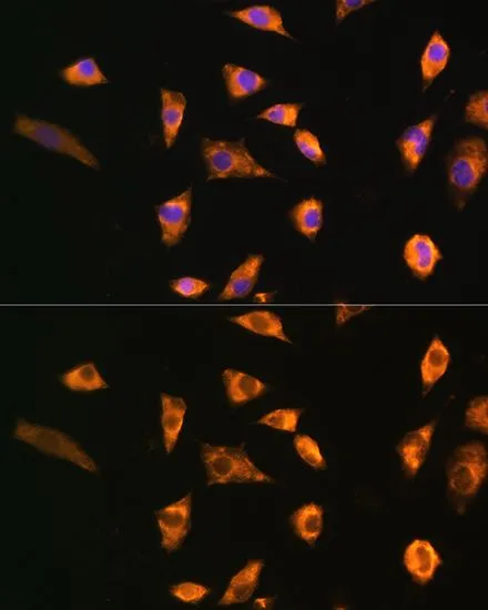 ICC/IF analysis of L929 cells using GTX65568 SPRR3 antibody. Blue : DAPI Dilution : 1:100