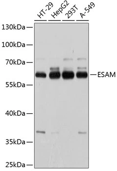 WB analysis of various sample lysates using GTX65572 ESAM antibody. Dilution : 1:1000 Loading : 25microg per lane