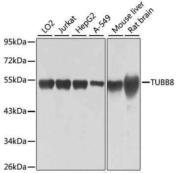 WB analysis of various sample lysates using GTX65574 beta Tubulin 8 antibody. Dilution : 1:1000 Loading : 25microg per lane WB analysis of various sample lysates using GTX65574 beta Tubulin 8 antibody. Dilution : 1:1000 Loading : 25microg per lane