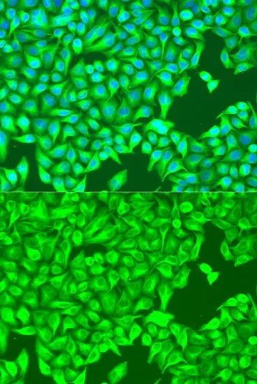 ICC/IF analysis of U2OS cells using GTX65574 beta Tubulin 8 antibody. Blue : DAPI Dilution : 1:100