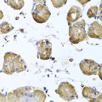 IHC-P analysis of human stomach tissue using GTX65574 beta Tubulin 8 antibody. Dilution : 1:100