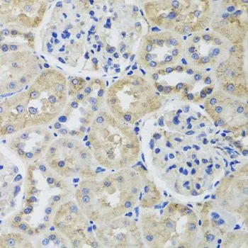 IHC-P analysis of rat kidney tissue using GTX65574 beta Tubulin 8 antibody. Dilution : 1:100