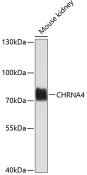 WB analysis of mouse kidney tissue lysate using GTX65576 AChR alpha 4 antibody. Dilution : 1:1000 Loading : 25microg per lane WB analysis of mouse kidney tissue lysate using GTX65576 AChR alpha 4 antibody. Dilution : 1:1000 Loading : 25microg per lane