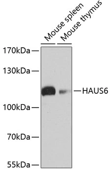 WB analysis of various sample lysates using GTX65582 HAUS6 antibody. Dilution : 1:1000 Loading : 25microg per lane WB analysis of various sample lysates using GTX65582 HAUS6 antibody. Dilution : 1:1000 Loading : 25microg per lane