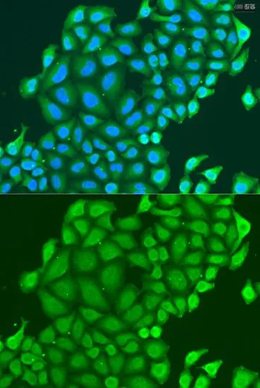 ICC/IF analysis of U2OS cells using GTX65582 HAUS6 antibody. Blue : DAPI Dilution : 1:100