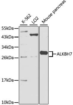 WB analysis of various sample lysates using GTX65589 ALKBH7 antibody. Dilution : 1:1000 Loading : 25microg per lane WB analysis of various sample lysates using GTX65589 ALKBH7 antibody. Dilution : 1:1000 Loading : 25microg per lane