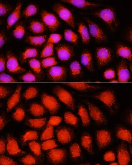 ICC/IF analysis of HeLa cells using GTX65594 DNAJB14 antibody. Blue : DAPI Dilution : 1:100