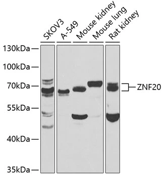 WB analysis of various sample lysates using GTX65596 ZNF20 antibody. Dilution : 1:1000 Loading : 25microg per lane WB analysis of various sample lysates using GTX65596 ZNF20 antibody. Dilution : 1:1000 Loading : 25microg per lane