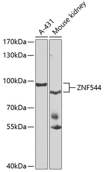 WB analysis of various sample lysates using GTX65597 ZNF544 antibody. The signal was developed with ECL plus-Enhanced. Dilution : 1:1000 Loading : 25microg per lane WB analysis of various sample lysates using GTX65597 ZNF544 antibody. The signal was developed with ECL plus-Enhanced. Dilution : 1:1000 Loading : 25microg per lane