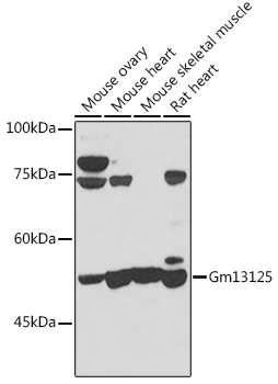 WB analysis of various sample lysates using GTX65598 Gm13125 antibody. Dilution : 1:1000 Loading : 25microg per lane WB analysis of various sample lysates using GTX65598 Gm13125 antibody. Dilution : 1:1000 Loading : 25microg per lane