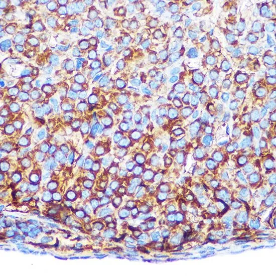 IHC-P analysis of mouse ovary tissue using GTX65598 Gm13125 antibody. Dilution : 1:100
