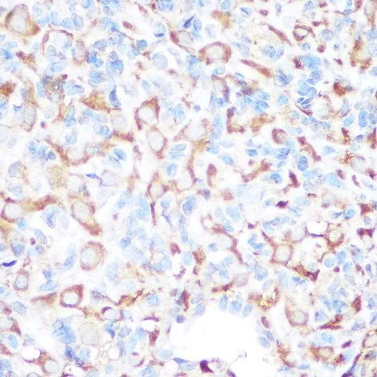 IHC-P analysis of rat ovary tissue using GTX65598 Gm13125 antibody. Dilution : 1:100