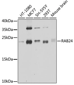 WB analysis of various sample lysates using GTX65600 RAB24 antibody. The signal was developed with ECL plus-Enhanced. Dilution : 1:1000 Loading : 25microg per lane