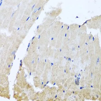 IHC-P analysis of mouse heart tissue using GTX65600 RAB24 antibody. Dilution : 1:100