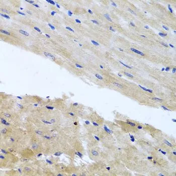 IHC-P analysis of rat heart tissue using GTX65600 RAB24 antibody. Dilution : 1:100