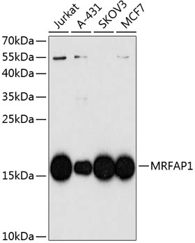 WB analysis of various sample lysates using GTX65604 MRFAP1 antibody. Dilution : 1:1000 Loading : 25microg per lane WB analysis of various sample lysates using GTX65604 MRFAP1 antibody. Dilution : 1:1000 Loading : 25microg per lane