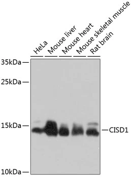 WB analysis of various sample lysates using GTX65611 CISD1 antibody. Dilution : 1:1000 Loading : 25microg per lane WB analysis of various sample lysates using GTX65611 CISD1 antibody. Dilution : 1:1000 Loading : 25microg per lane