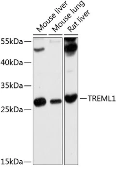 WB analysis of various sample lysates using GTX65612 TREML1 antibody. Dilution : 1:1000 Loading : 25microg per lane WB analysis of various sample lysates using GTX65612 TREML1 antibody. Dilution : 1:1000 Loading : 25microg per lane