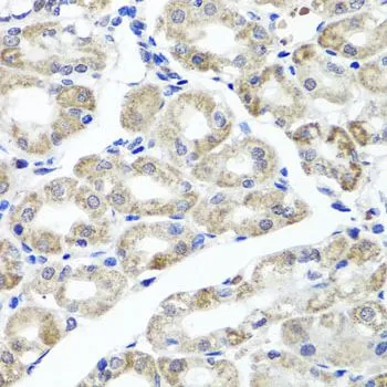 IHC-P analysis of human stomach tissue using GTX65625 MAPKBP1 antibody. Dilution : 1:100