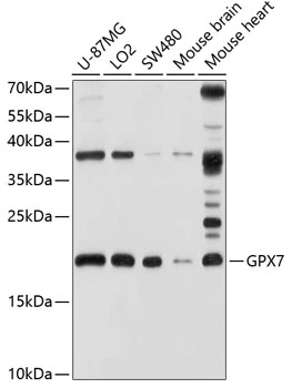 WB analysis of various sample lysates using GTX65626 GPX7 antibody. Dilution : 1:1000 Loading : 25microg per lane