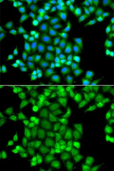 ICC/IF analysis of A549 cells using GTX65807 PAK2 antibody. Blue : DAPI