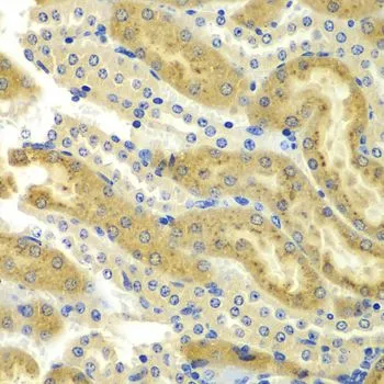 IHC-P analysis of mouse kidney tissue using GTX65807 PAK2 antibody. Dilution : 1:100